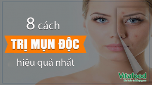 cách trị mụn nhọt độc siêu hiệu quả